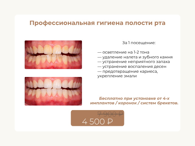 Осмотр стоматологом + план лечения БЕСПЛАТНО