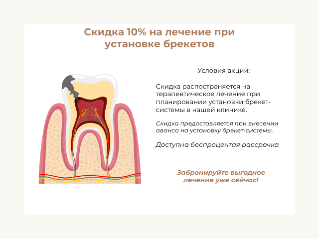 Профессиональная гигиена полости рта