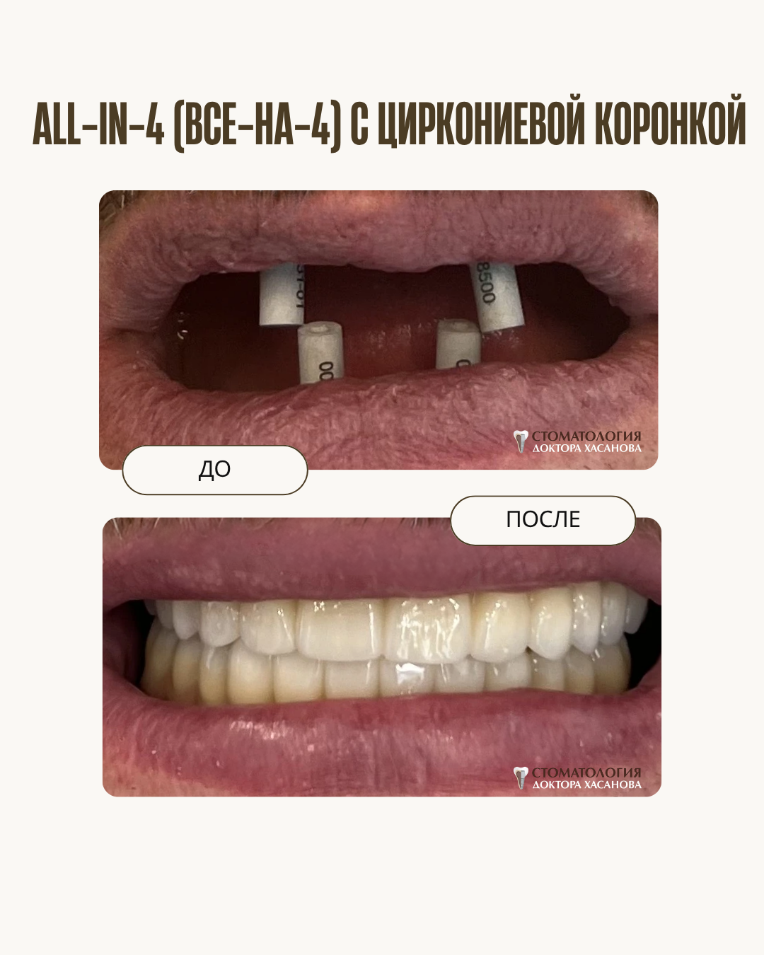 До и после