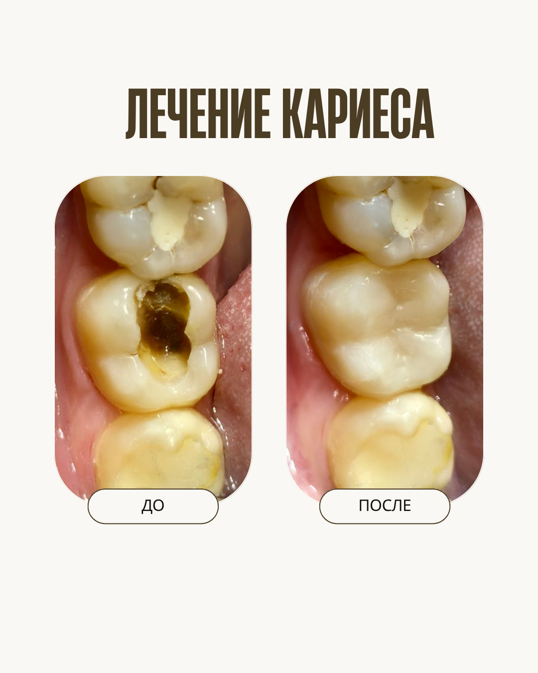 До и после