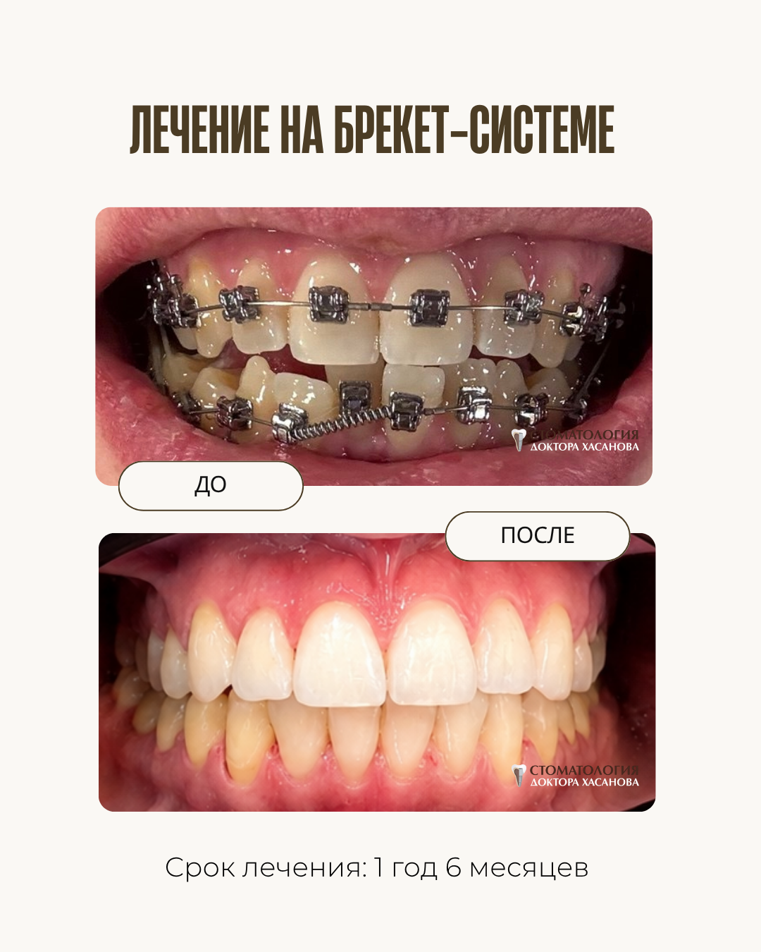 До и после
