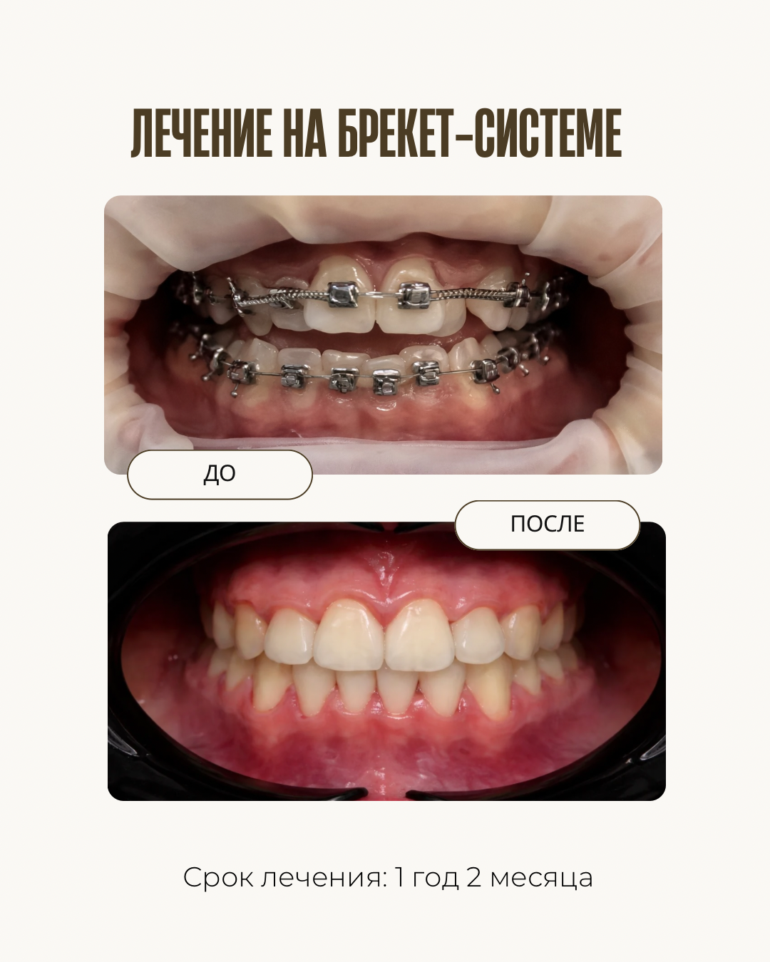 До и после