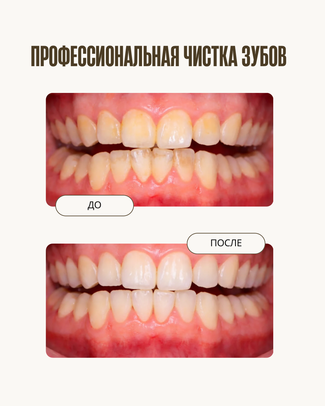 До и после