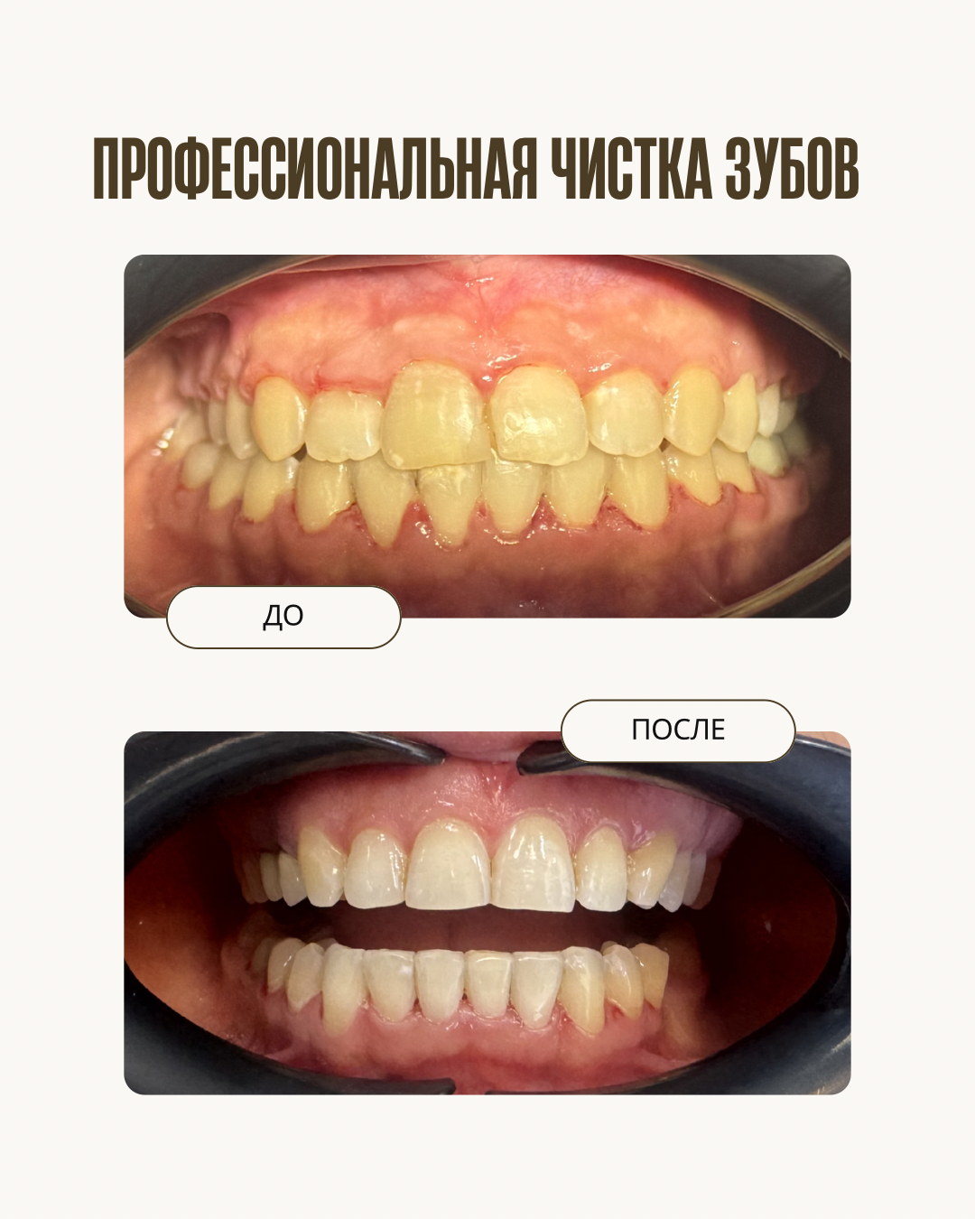 До и после